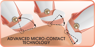 Micro-Contact